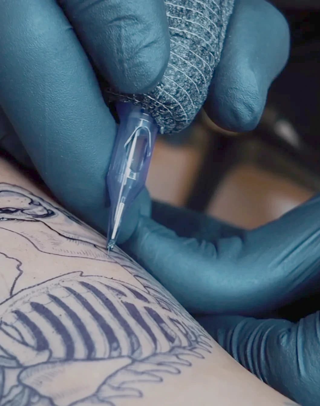 The needle and skin